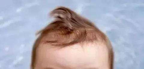 宝宝头发又稀又黄?想要变得浓密,关键就一个字_胎毛