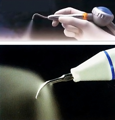 正规医院洗牙的过程 诺尔漫齿科洗牙流程