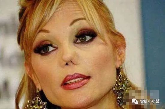 整形失败了怎么办?如何避免越来越糟的情况出现?|日本医美_手术