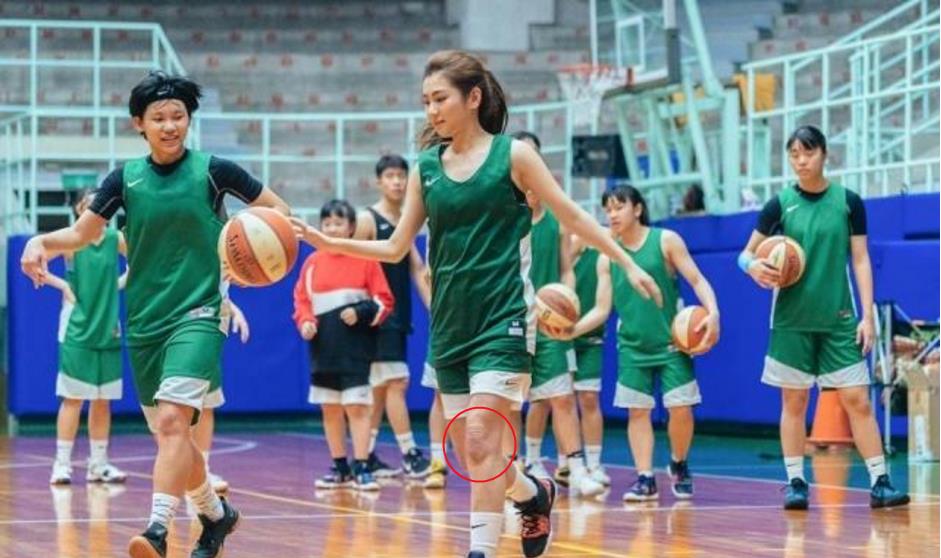 时隔8年,任家萱变身篮球美少女,首次展露腿部烧伤疤痕惹人疼