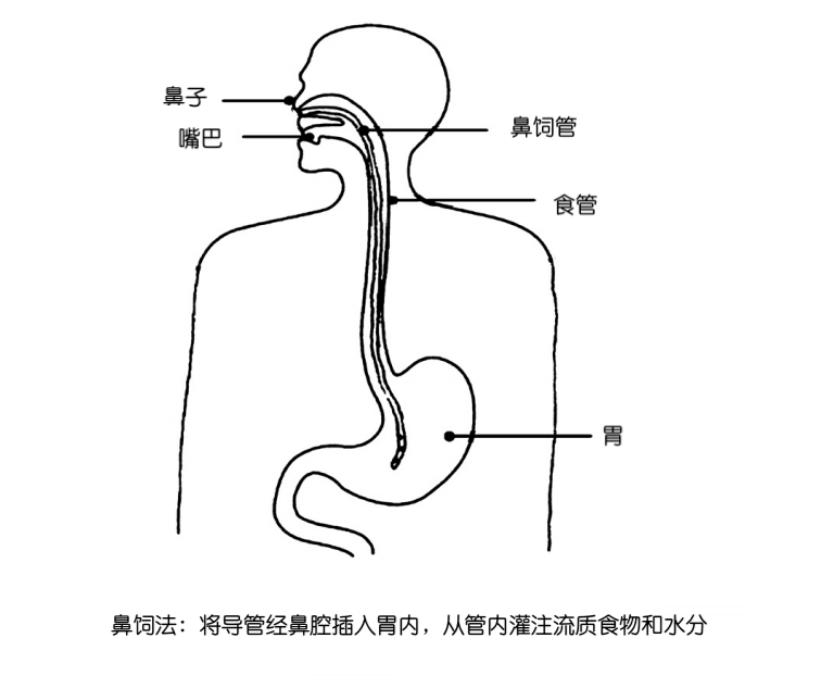 鼻饲法 