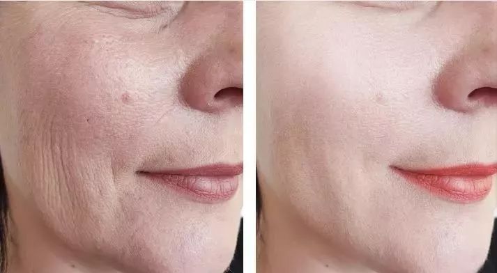 巩俐的脸真的种满黄金丝吗?