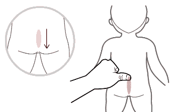 第四个手法是揉龟尾,这个穴位就是在尾骨端的这个点,推拿时轻轻的揉按