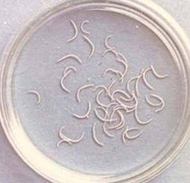 钩虫幼虫还可以穿透人类皮肤,会导致皮肤局部反应,肿胀和发痒,幼虫还