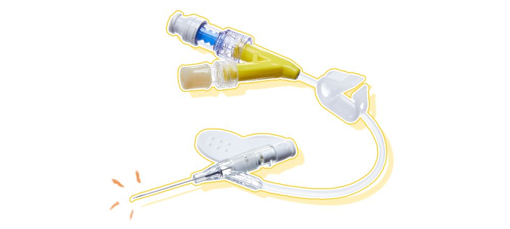 让儿科病房少一些啼哭输液选针有讲究