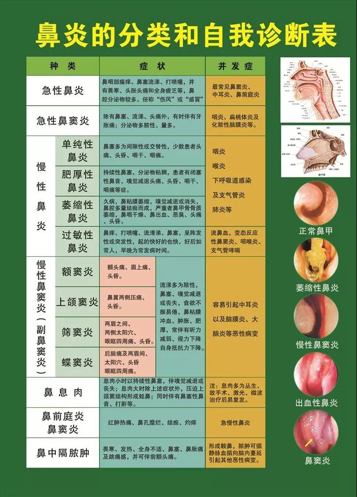 不做风流人物用它5天见效告别鼻炎困扰