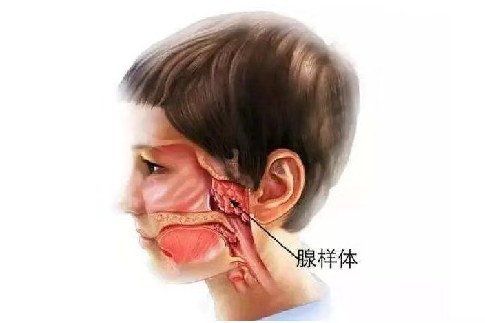儿童缺乏专注力,或患腺样体肥大