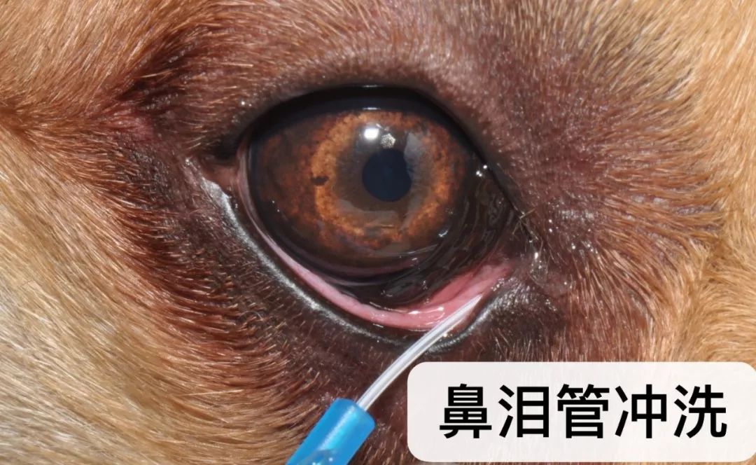 温馨提醒:请勿盲目的对鼻泪管进行物理性冲洗,因为本身冲洗针就会对鼻