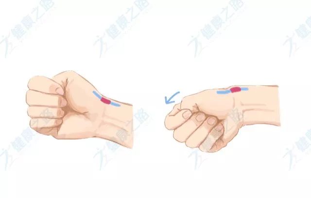 4個小動作,助你擺脫腱鞘炎!_手指