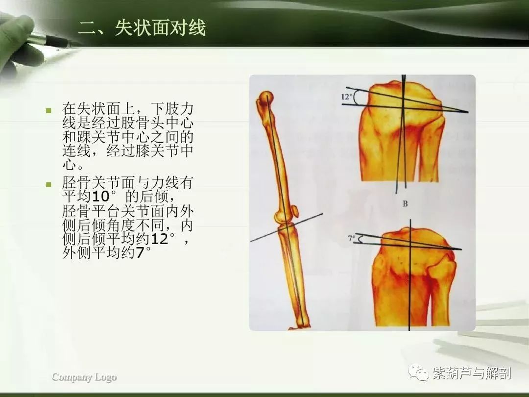 体态评估下肢生物力线检测及其临床意义