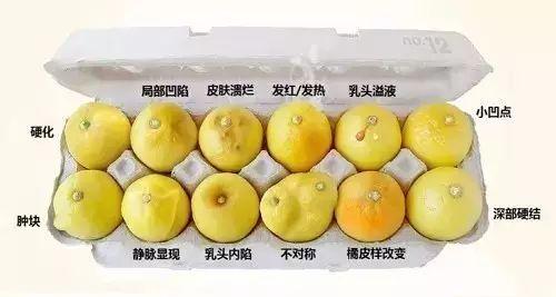 乳腺癌像橘子皮图片图片