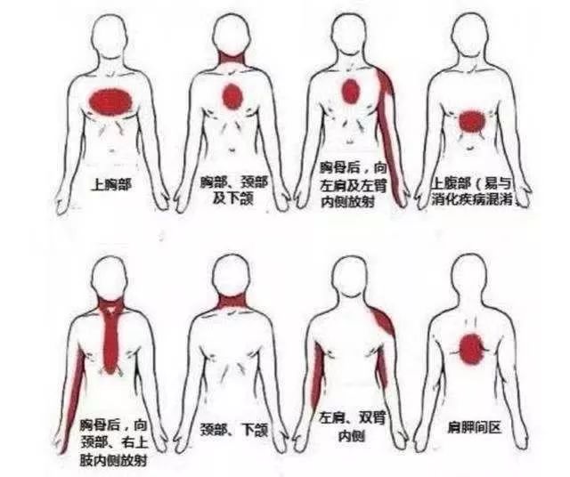 护士姐姐教你如何识别胸痛与如何对症处理