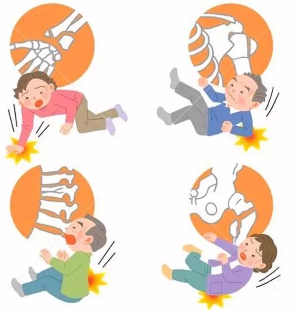 跌倒的高危人群1年龄大于65岁的病人;2曾有跌倒病史者;3贫血或血压不