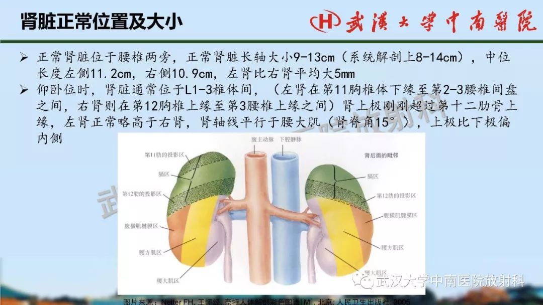 肾脏解剖与实性肿瘤的ctmri诊断梅列军