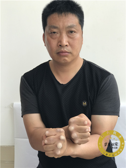 何氏散手第四代传承人风采铁锤盛化周