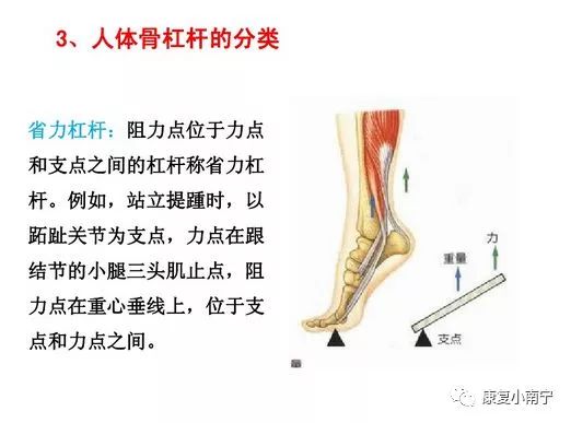 肌肉拉力线示意图图片