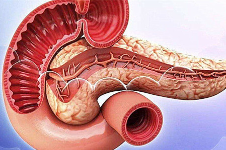 早期胰脏癌或没有症状,想避开胰脏癌应该了解什么呢?