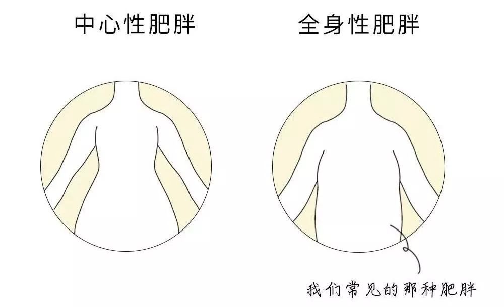 中心性肥胖他们的胖叫做隐形肥胖者其实是因为有的瘦子瘦子也会得