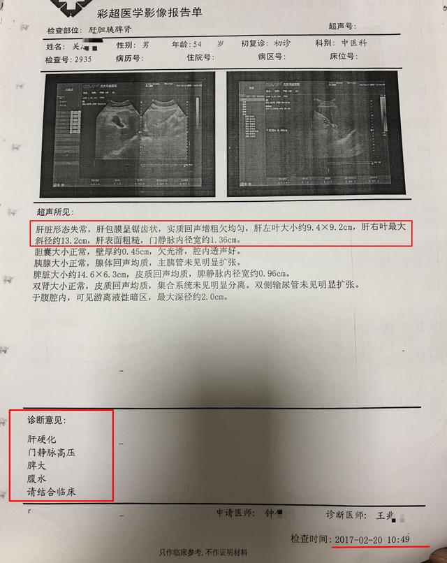钟伟医生健康谈肝硬化腹水别放弃治疗中医治疗有效