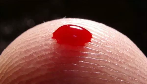 刺血疗法大全,看这一篇就够了!_针刺