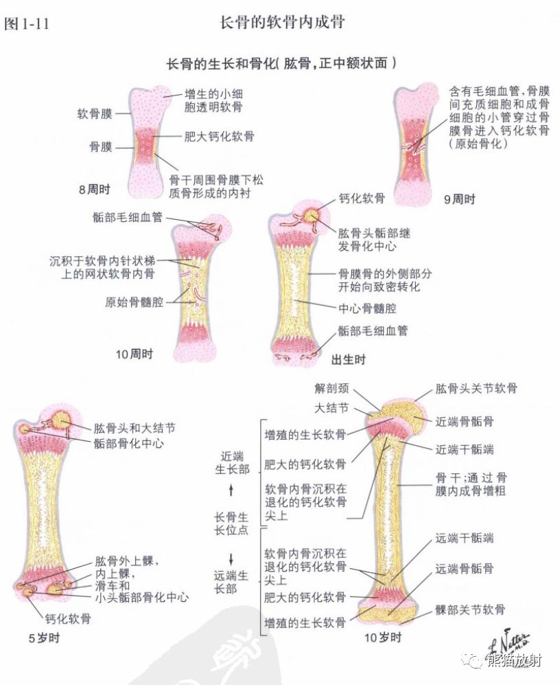 奈特图谱丨骨形成代谢性骨病