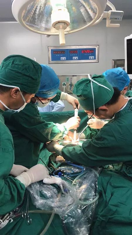 我院外科成功开展一例腹腔镜下胃大部切除术_手术