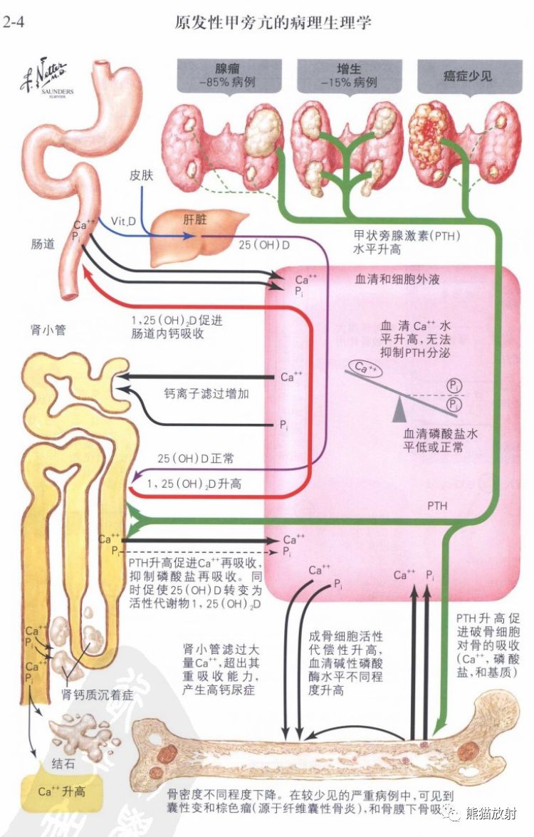 奈特图谱丨骨形成代谢性骨病