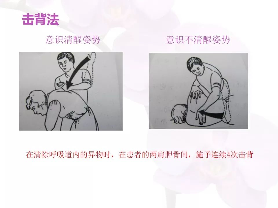 ppt如何救助噎食误吸的老年人