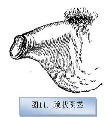 包皮割与不割?误切可能毁孩子一辈子……_阴茎