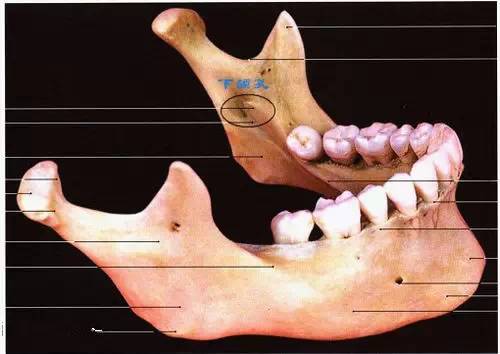 (7)下牙槽,舌,颊神经一次阻滞麻醉,亦称下颌支内侧隆突阻滞麻醉(6)