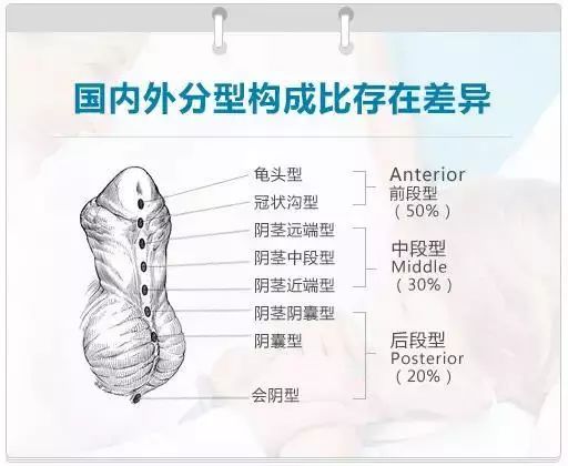 正常的阴痉图片