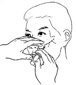 入腭大孔或其附近以麻醉腭前神经,又叫腭大孔注射法图示同图—36(5)