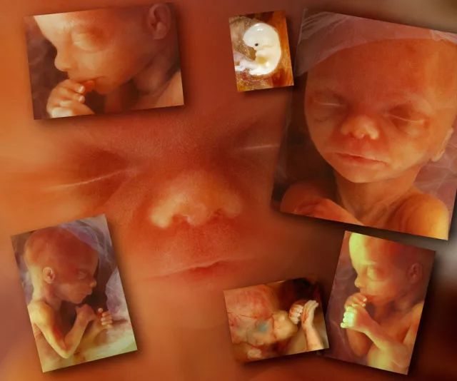 22周胎儿性别清晰大图图片