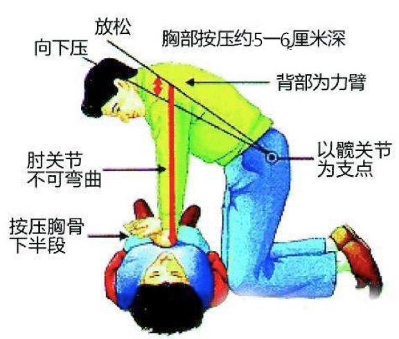 开放气道的三种方法图片