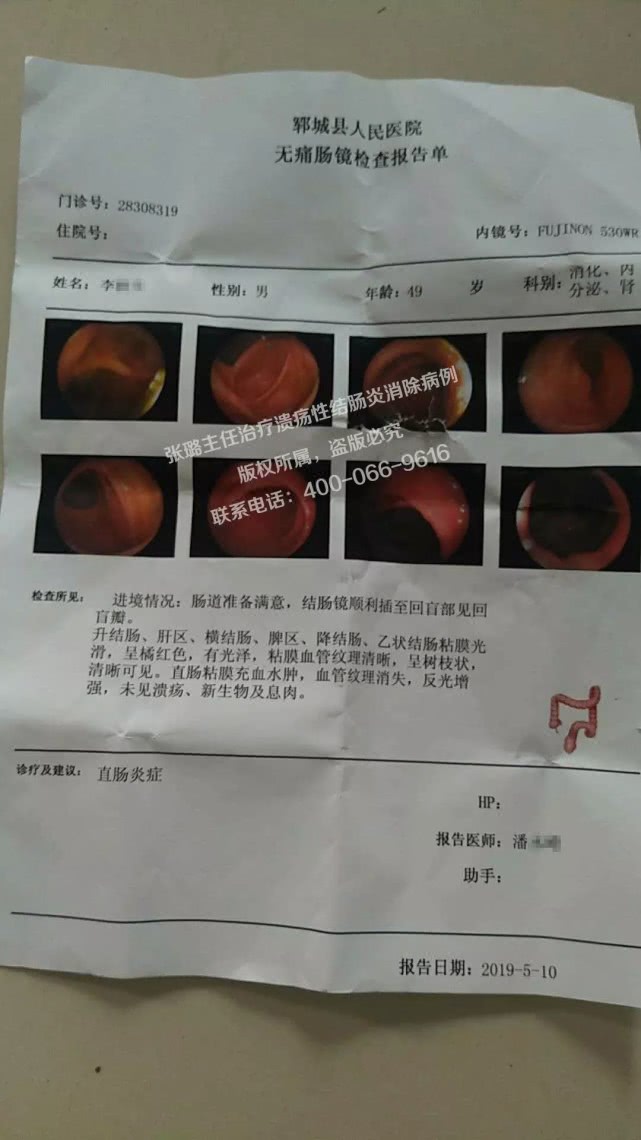 肠胃炎检查单子图片图片