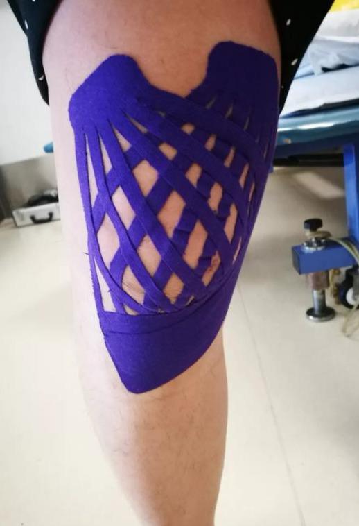 五颜六色的惊喜肌内效贴kinesiotaping