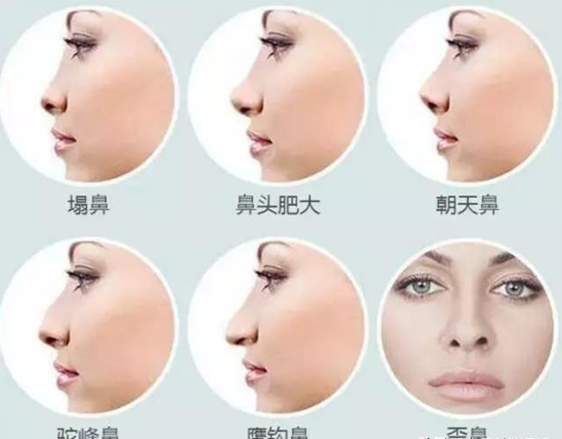 女人鼻型一般分5种,三种好看,两种丑,你是哪种?