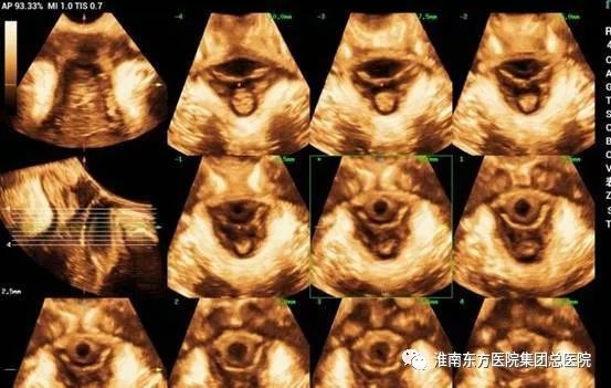 【请您关注】东方超声新技术,照亮妇婴健康之路
