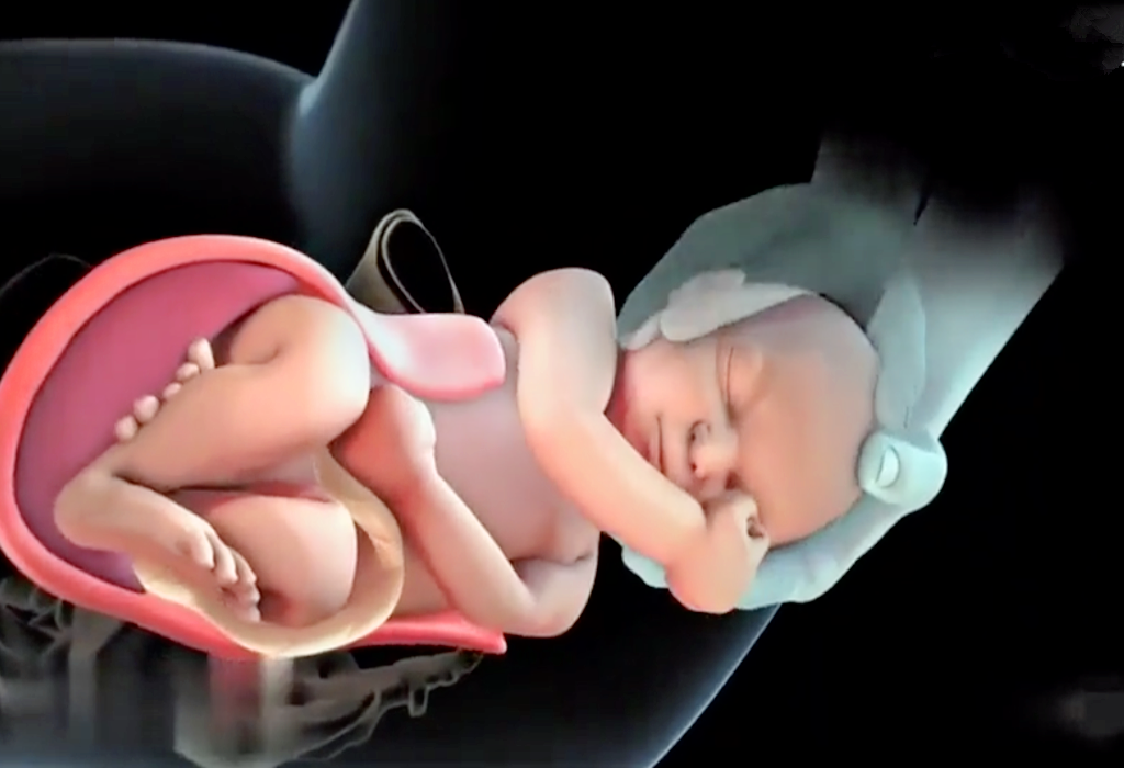 产道这么小宝宝咋生出来的3d图展示整个过程男生该看看