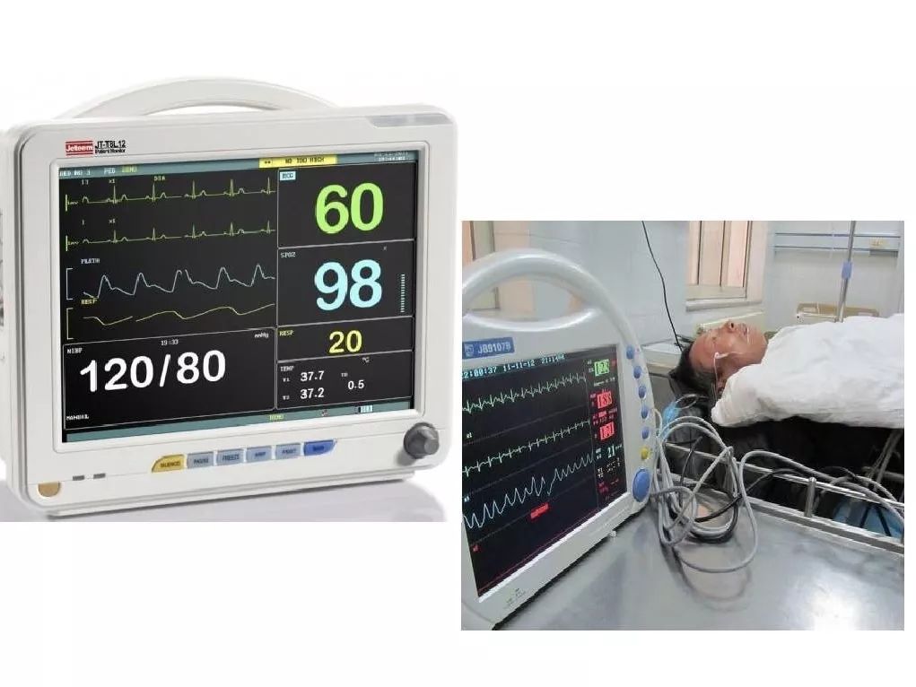 业务学习监测生命体征提高生存机率