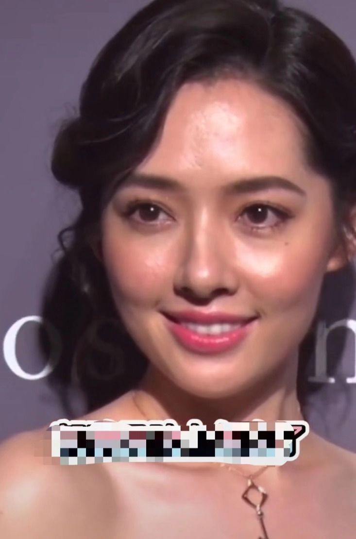 郭碧婷嫁向佐越来越丑?生图脸僵下巴歪苹果肌肿,满脸油腻全是坑