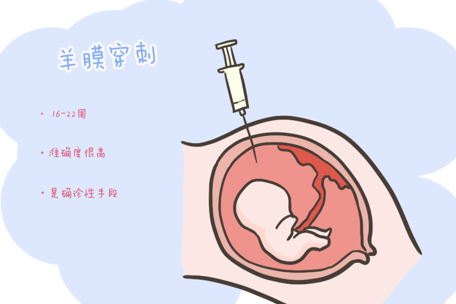 產檢時,孕媽唐篩高風險,究竟要不要做羊水穿刺?看完就明白了!