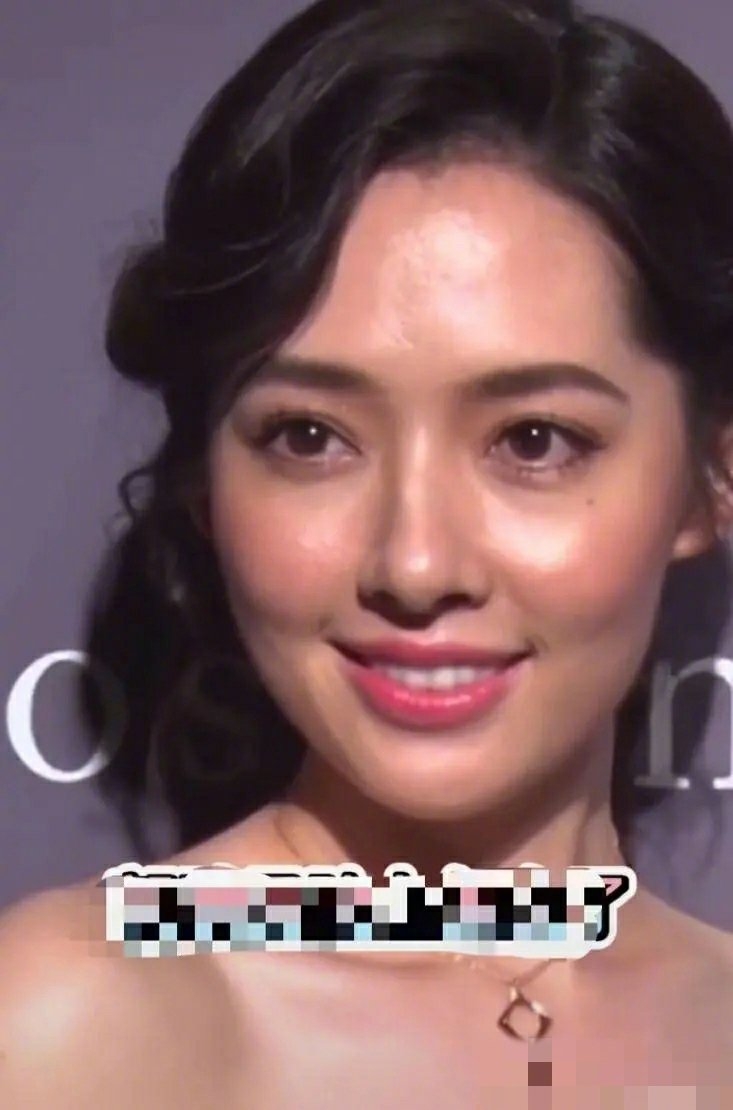 郭碧婷这是怎么了脸僵下巴歪颜值暴跌生图看着比向佐还油腻