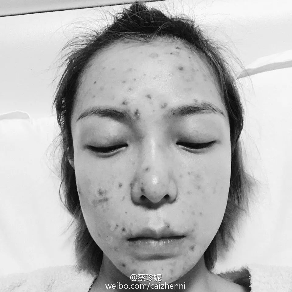 盘点娱乐圈少女脸100的人每天都做的一件事会的人冻龄错的人烂脸