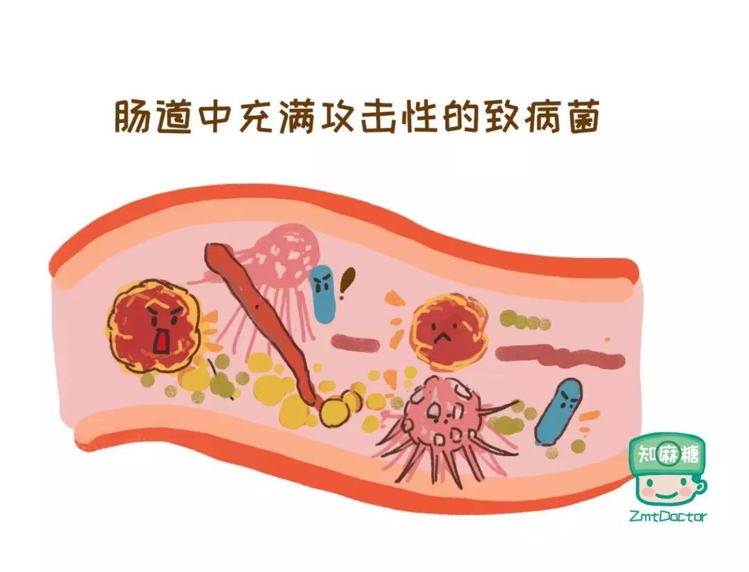 剖宫产又多了一宗罪会造成新生儿肠道菌群发育不良