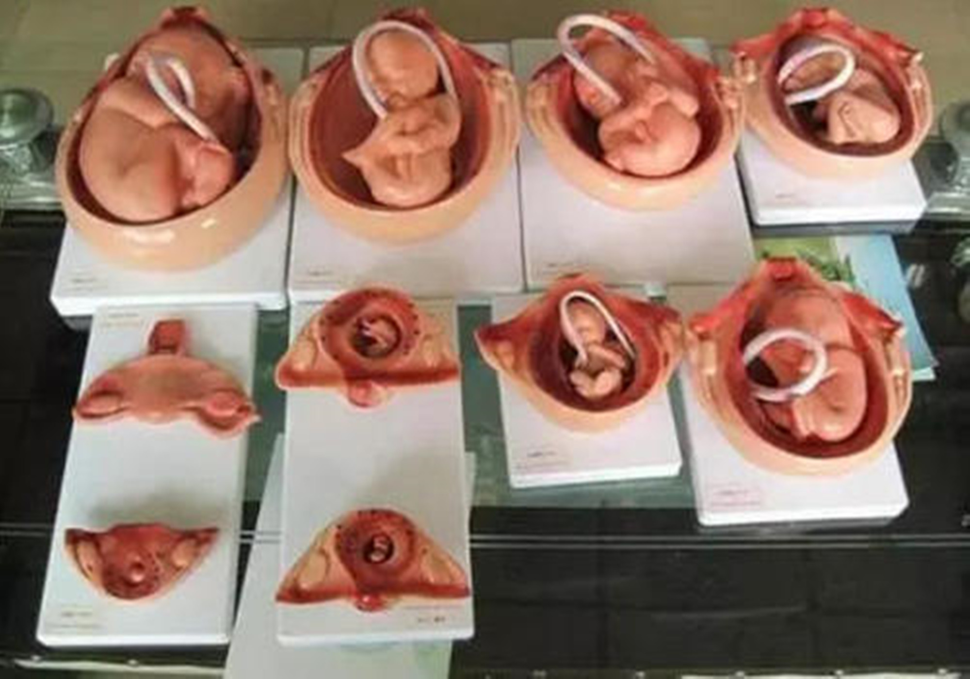 流产婴儿照片 胎儿图片