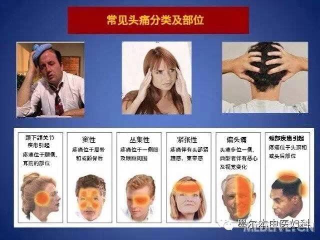 各种头痛位置图图片