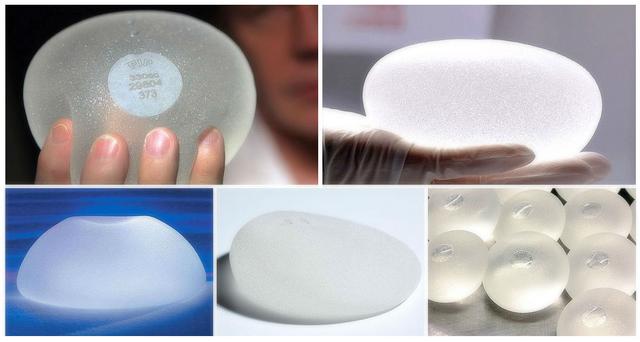 原则上硅胶假体隆胸效果是永久的,但考虑到随着时间的推移,硅胶假体