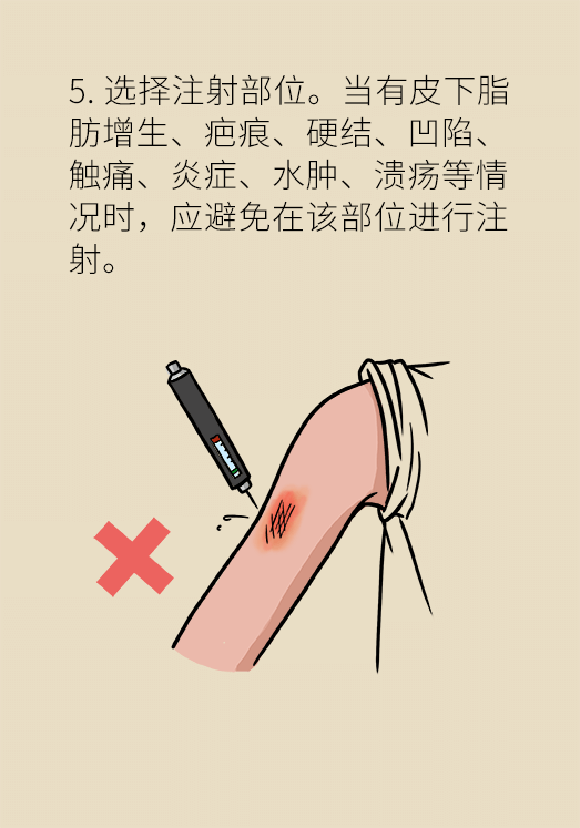 为自己,为家人,为朋友更多健康科普,小大夫漫画血糖,胰岛素,注射部位