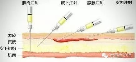 低分子肝素钙注射部位图片